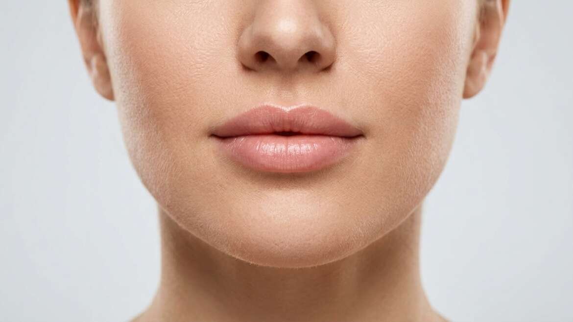 filler acido ialuronico labbra