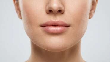 filler acido ialuronico labbra