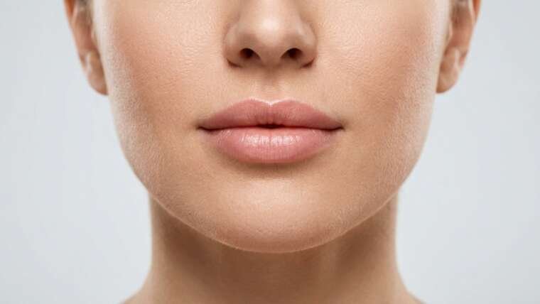 filler acido ialuronico labbra